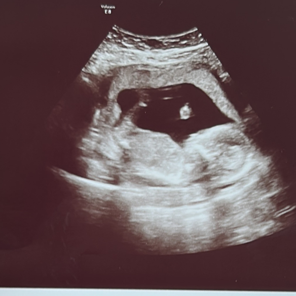 Babylist Registry Photo.