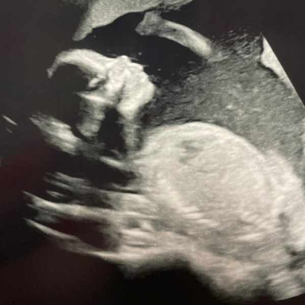 Babylist Registry Photo.