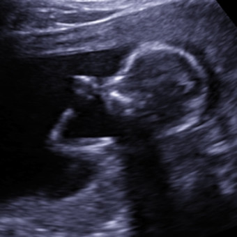 Babylist Registry Photo.