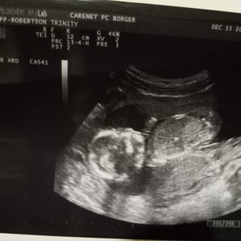 Babylist Registry Photo.