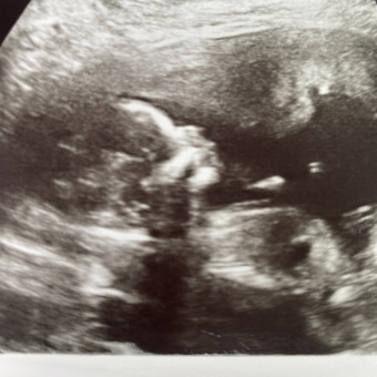 Babylist Registry Photo.