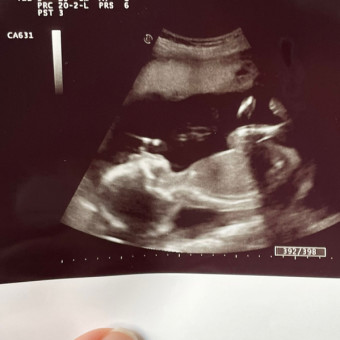 Babylist Registry Photo.