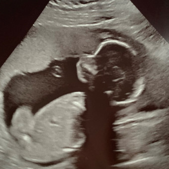 Babylist Registry Photo.