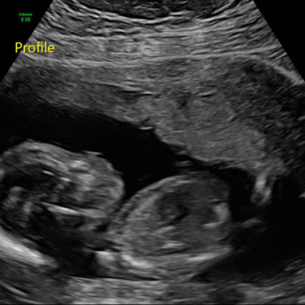 Babylist Registry Photo.