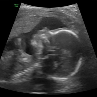Babylist Registry Photo.