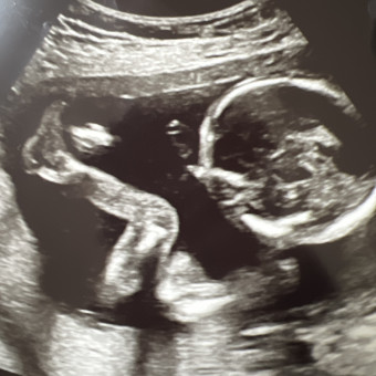 Babylist Registry Photo.