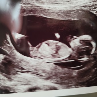 Nicolette's Baby Registry Photo.