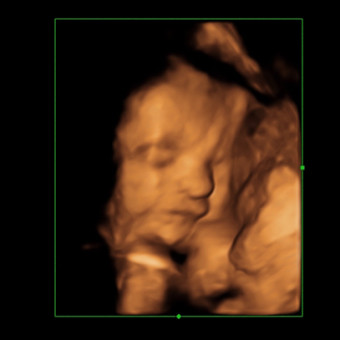 Babylist Registry Photo.