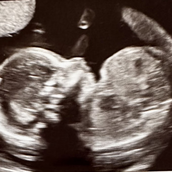 Babylist Registry Photo.