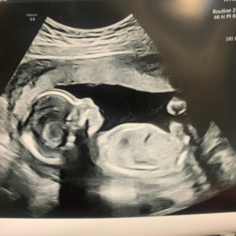 Babylist Registry Photo.