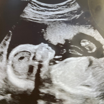 Babylist Registry Photo.