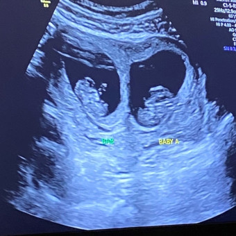Babylist Registry Photo.