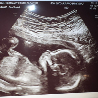 Babylist Registry Photo.