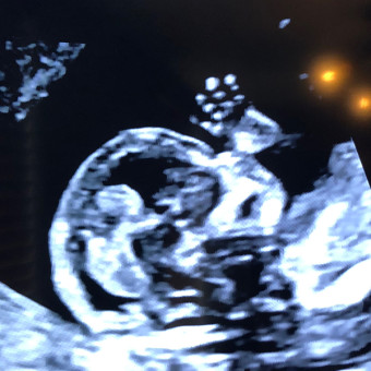 Babylist Registry Photo.