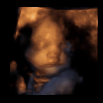 Babylist Registry Photo.