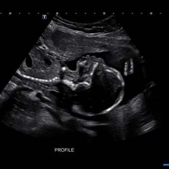 Babylist Registry Photo.