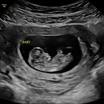 Kiersten's Baby Registry Photo.