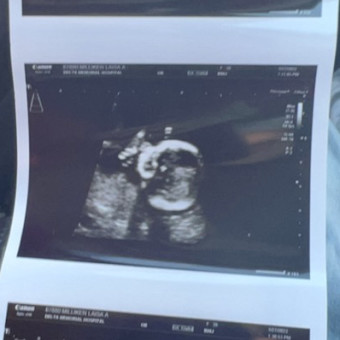 Laisa's Baby Registry Photo.