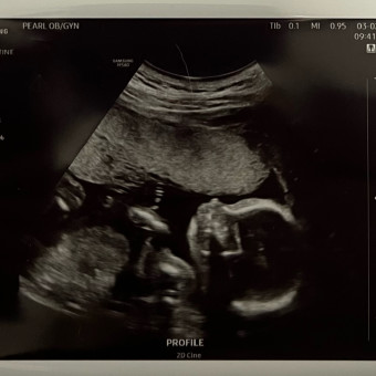 Babylist Registry Photo.
