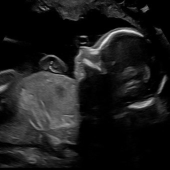 Babylist Registry Photo.