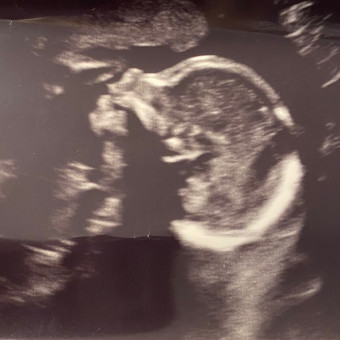 Babylist Registry Photo.