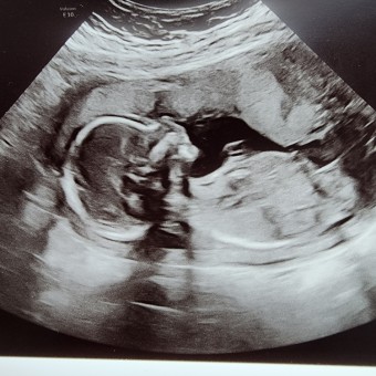 Babylist Registry Photo.