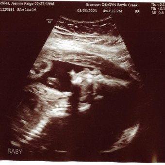 Knuckles Baby Registry Photo.