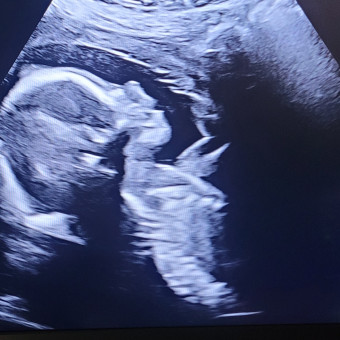 Babylist Registry Photo.