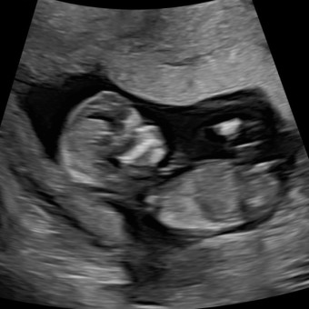 Babylist Registry Photo.