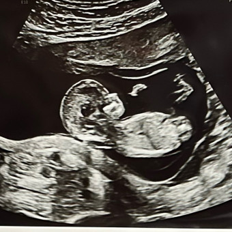 Alexis's Baby Registry Photo.
