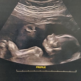 Babylist Registry Photo.