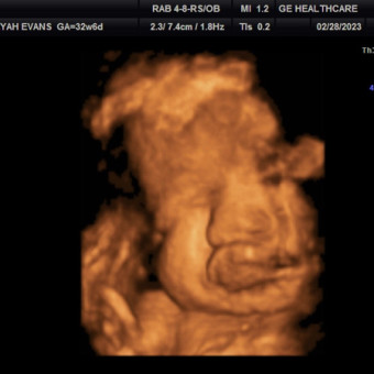 Babylist Registry Photo.