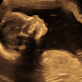 Patricia's Baby Registry Photo.