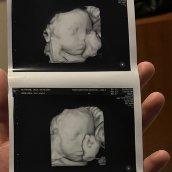 Talia's Baby Registry Photo.