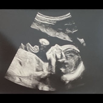 Babylist Registry Photo.
