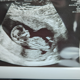 Babylist Registry Photo.