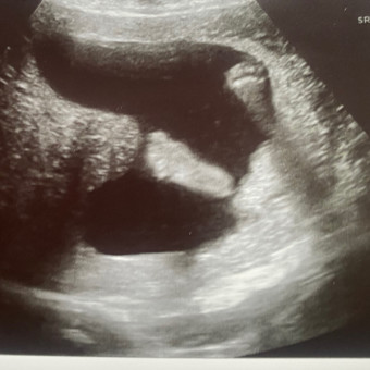 Rachael's Baby Registry Photo.