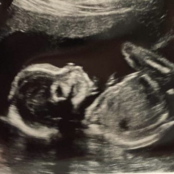 Kylie's Baby Registry Photo.