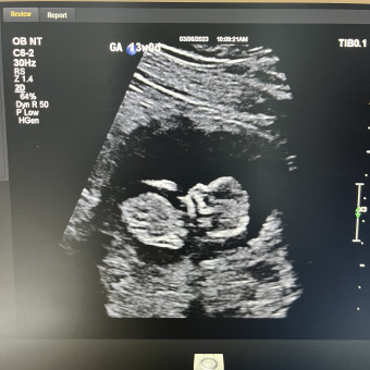 Babylist Registry Photo.