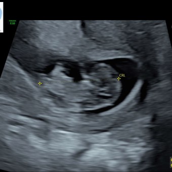 Kelsey's Baby Registry Photo.