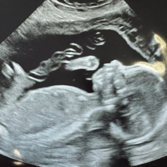 Babylist Registry Photo.