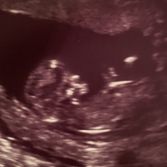 Babylist Registry Photo.