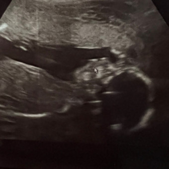 Caroline's Baby Registry Photo.