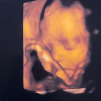 Babylist Registry Photo.