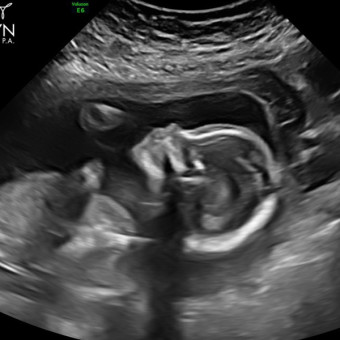 Babylist Registry Photo.