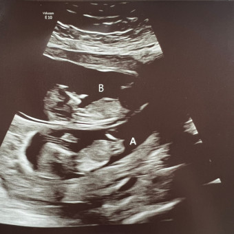Babylist Registry Photo.