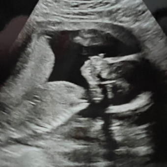 Machayla's Baby Registry Photo.