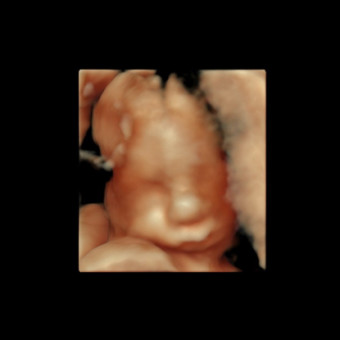 Babylist Registry Photo.