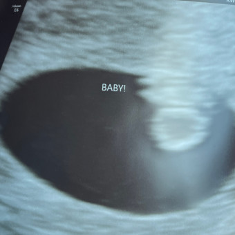Sarah's Baby Registry Photo.