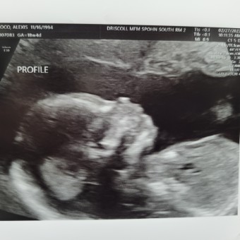 Sean & Lexie's Baby Registry Photo.